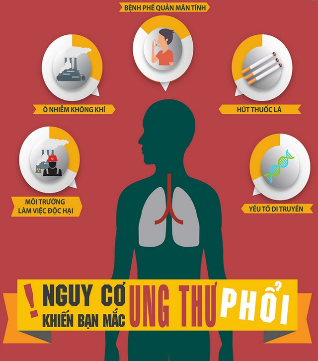 Ung thư phổi:Sàng lọc sớm hiệu quả điều trị cao