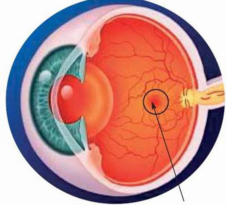 Thuốc giảm đau có liên quan đến thị giác